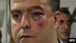 El diputado opositor Julio Borges, luego de ser golpeado por chavistas enel 30 de abril en la Asamblea Nacional.